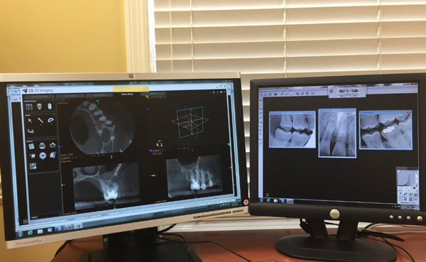 mid-jersey-endodontics-technology